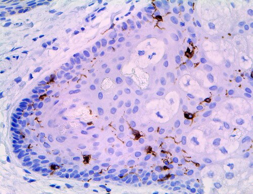 IHC of Langerin on an FFPE Skin Tissue
